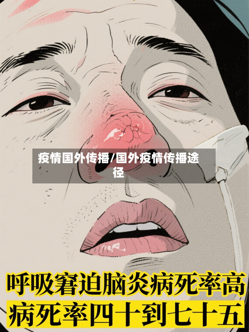 疫情国外传播/国外疫情传播途径-第2张图片