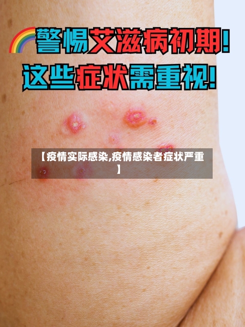 【疫情实际感染,疫情感染者症状严重】