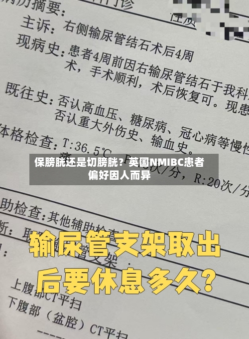保膀胱还是切膀胱?英国NMIBC患者偏好因人而异