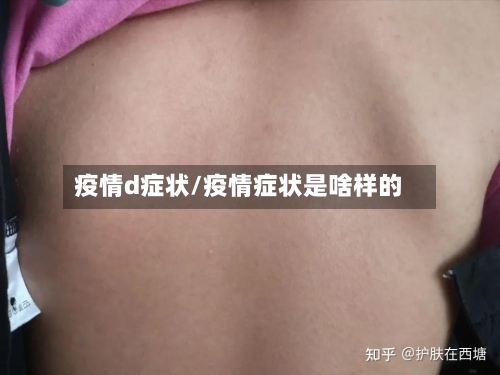 疫情d症状/疫情症状是啥样的